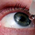 Putting an Eye Drop into an Eye