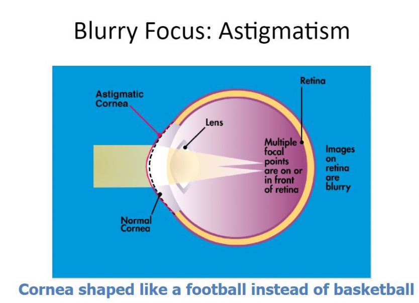astigmatism contact lenses how to put in